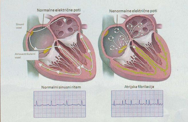 nemirno_srce.jpg 33FA223E-CA55-11E1-93A9-281566B94067